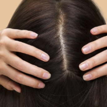 Nadmierne przetłuszczanie się włosów - porady