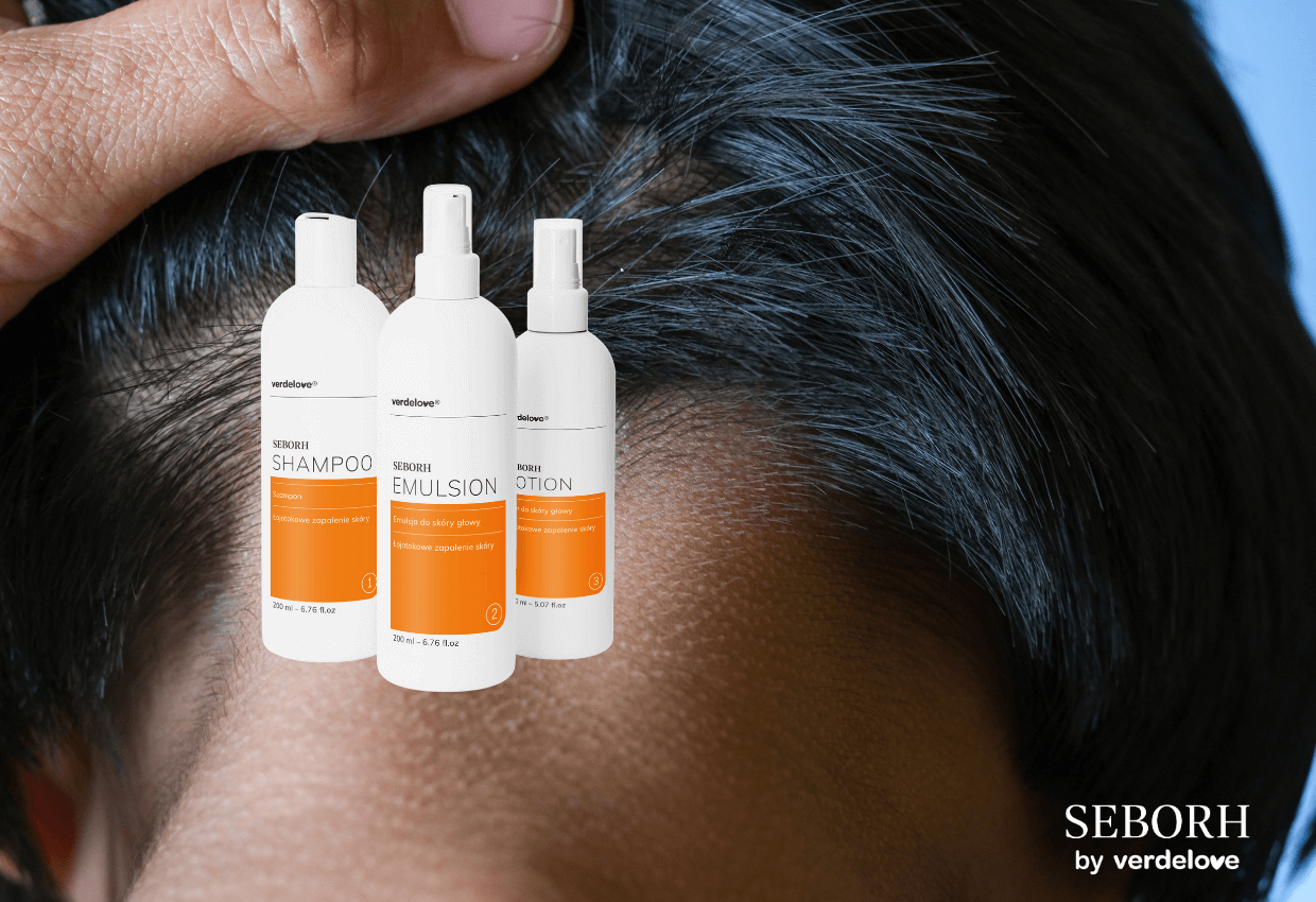 Jak działa krem na łojotokowe zapalenie skóry? Składniki i mechanizm działania